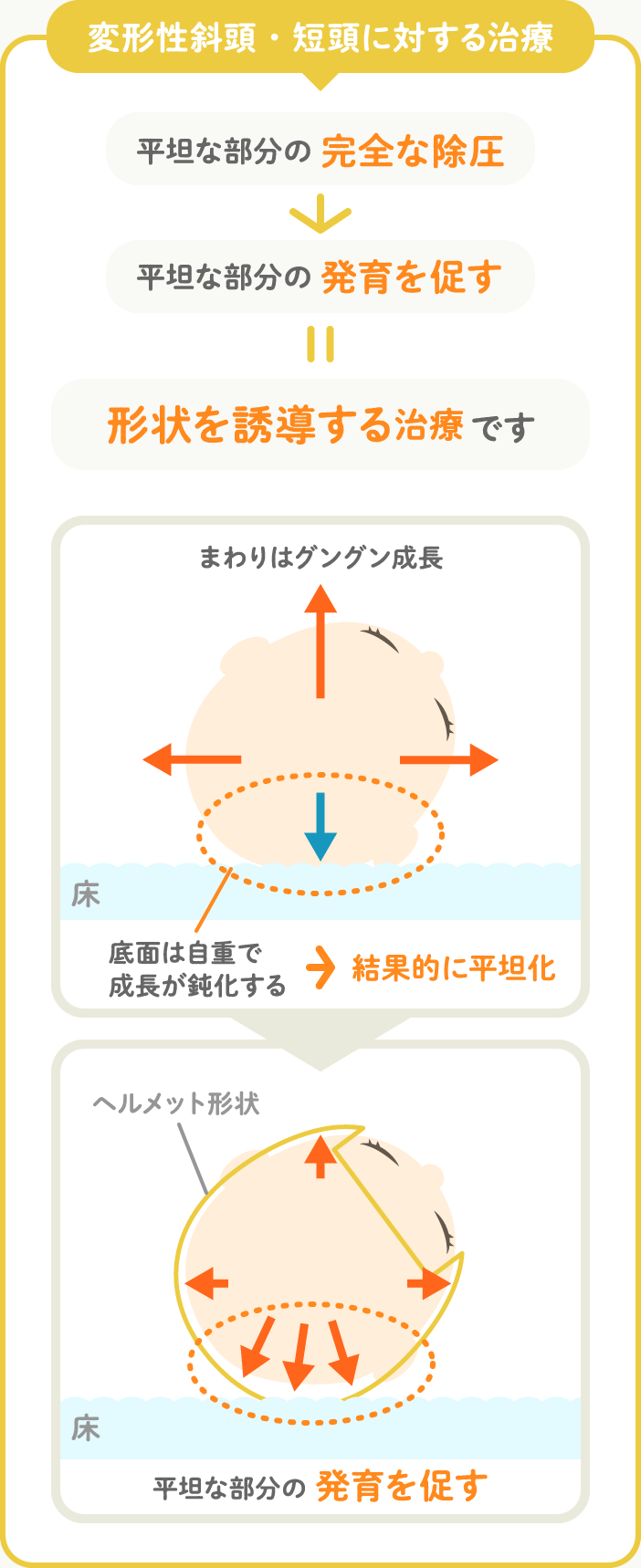 ヘルメット治療とは、形状を誘導する治療です
